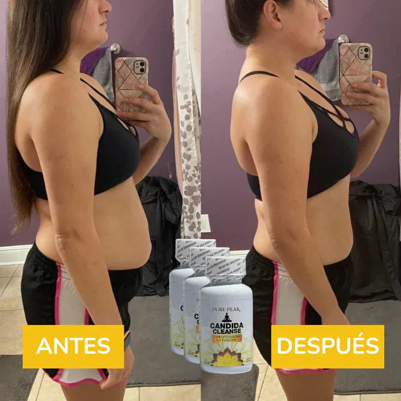 Candida Cleanse ® – Acazza.cl